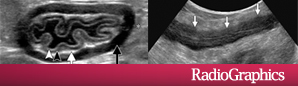 RadioGraphics 35.1 - Figure 1 RadioGraphics 35.1 - Figure 1