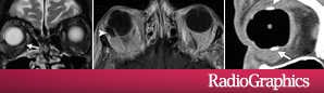 RadioGraphics 35.1 - Figure 2 RadioGraphics 35.1 - Figure 2