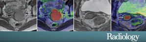 Radiology 274.3 Figure Radiology 274.3 Figure