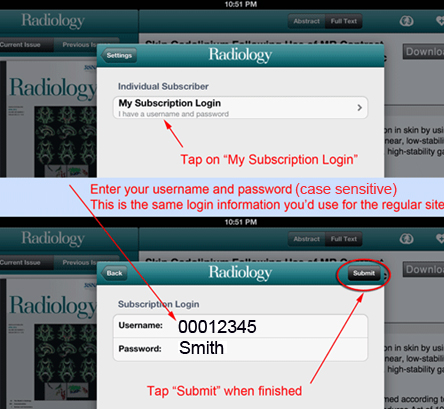Authenticate Your Subscription