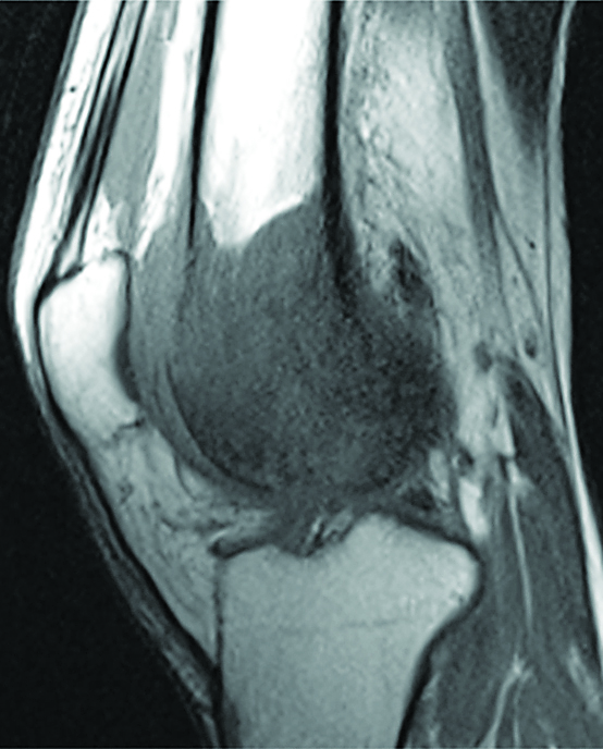 Nov_Fayad Figure 1a