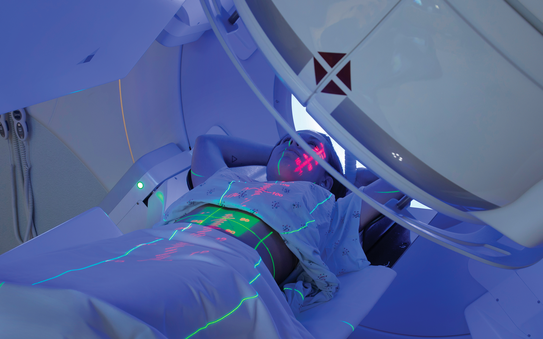 Stereotactic Body Radiation Therapy: A New Paradigm For Radiation ...