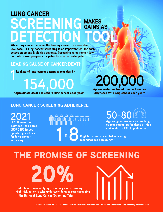 Lung Cancer Screening Infographic | RSNA