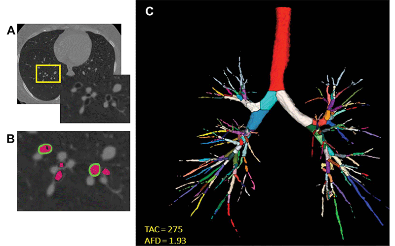 RSNA News | RSNA